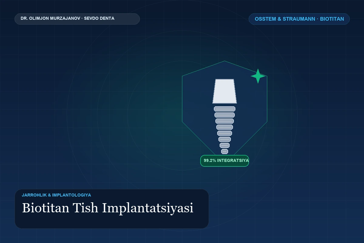 Tish Implantatsiyasi (Osstem va Straumann)
